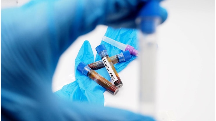 La Regione indica i laboratori per i test Hantavirus. Sono i policlinici di Palermo e Catania - la Repubblica