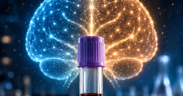 Alzheimer, un esame del sangue può anticipare il rischio di declino cognitivo