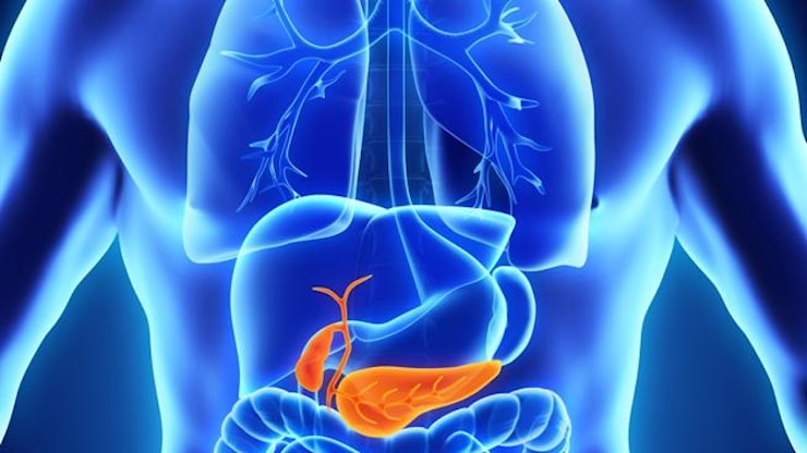 Tumore del pancreas, un nuovo farmaco rivoluziona le cure - Corriere della Sera
